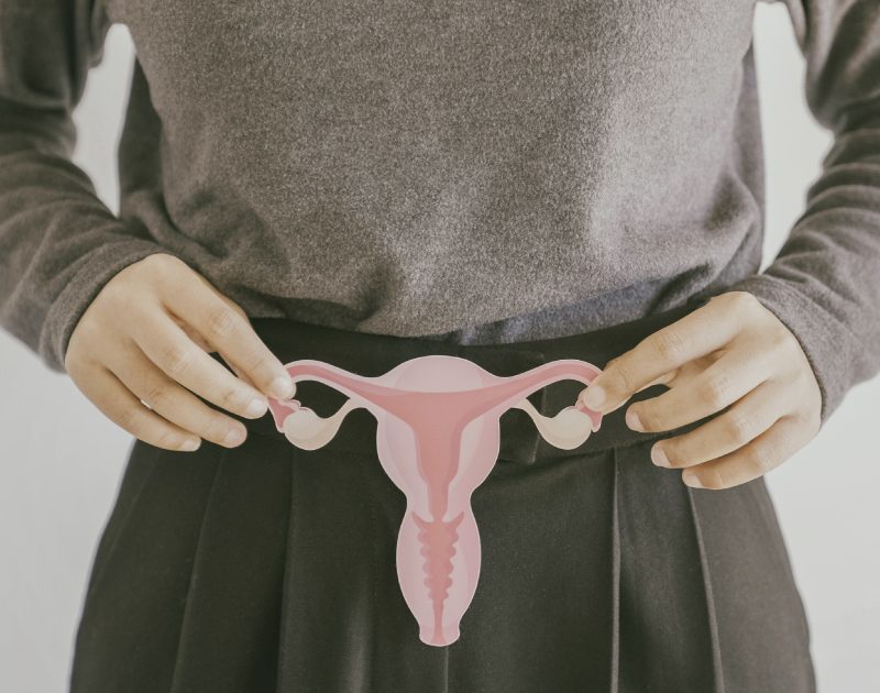 Cómo abordar la endometriosis