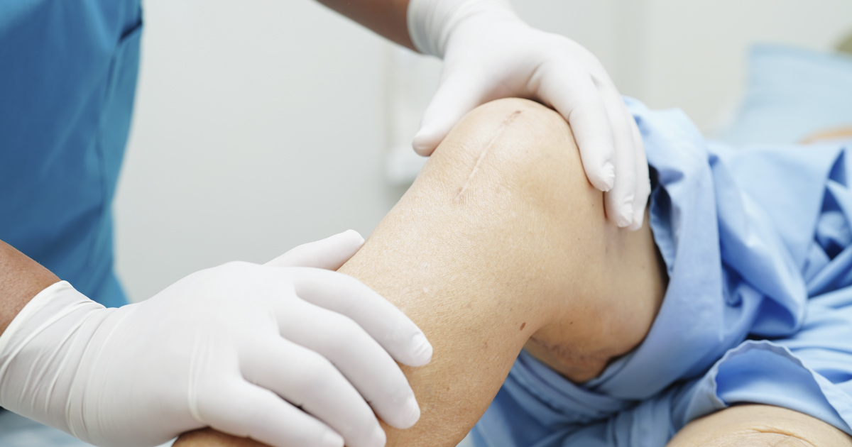 ¿Es la fisioterapia esencial en la recuperación después de una cirugía?